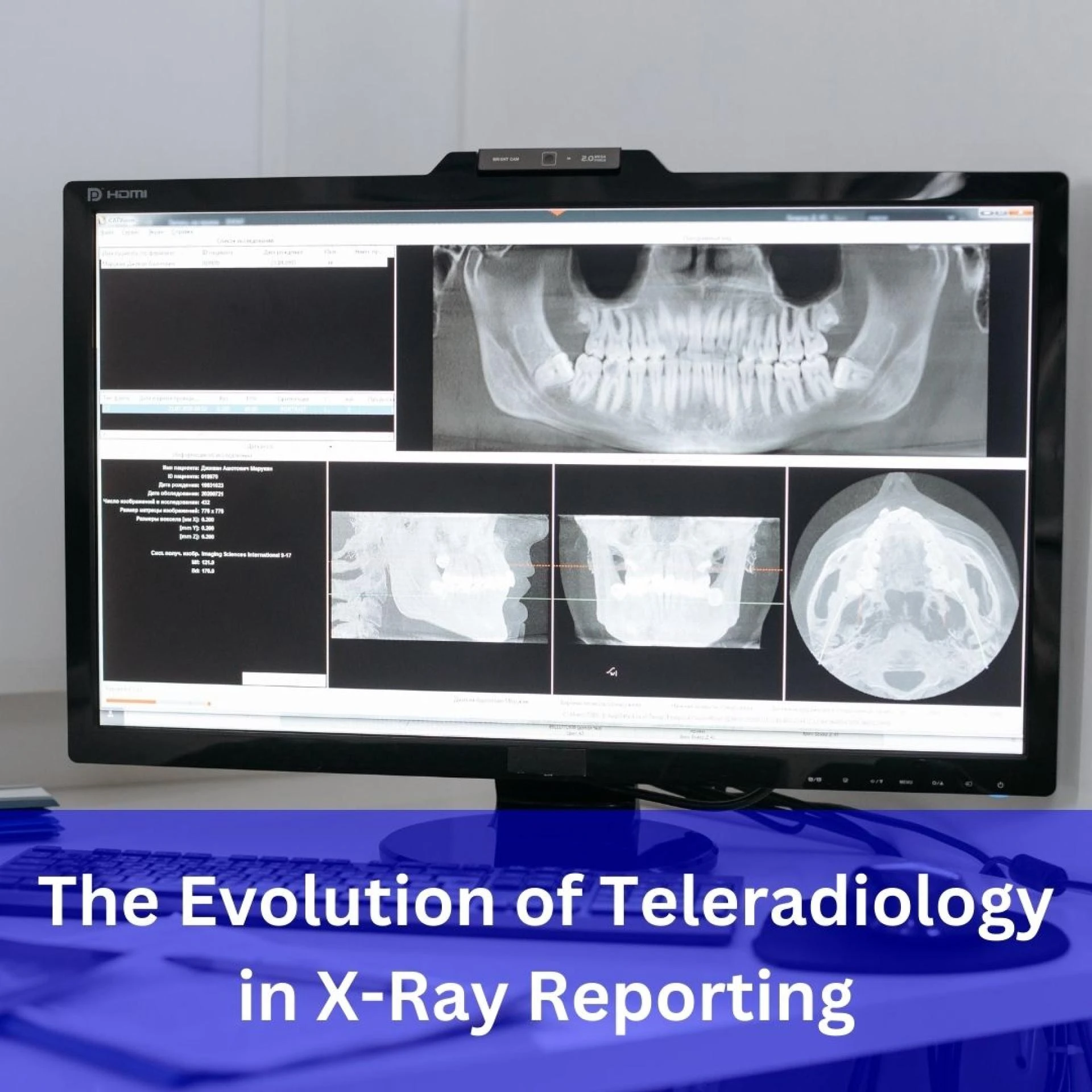 The Evolution of Teleradiology in X-Ray Reporting