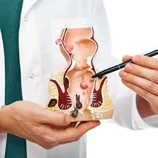 Best Piles Doctor In Mumbai