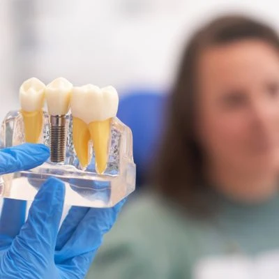 How Dental Implants Are Revolutionizing the Treatment of Missing Teeth
