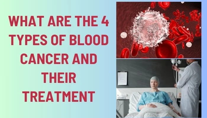 What Are The 4 Types Of Blood Cancer And Their Treatment: Details