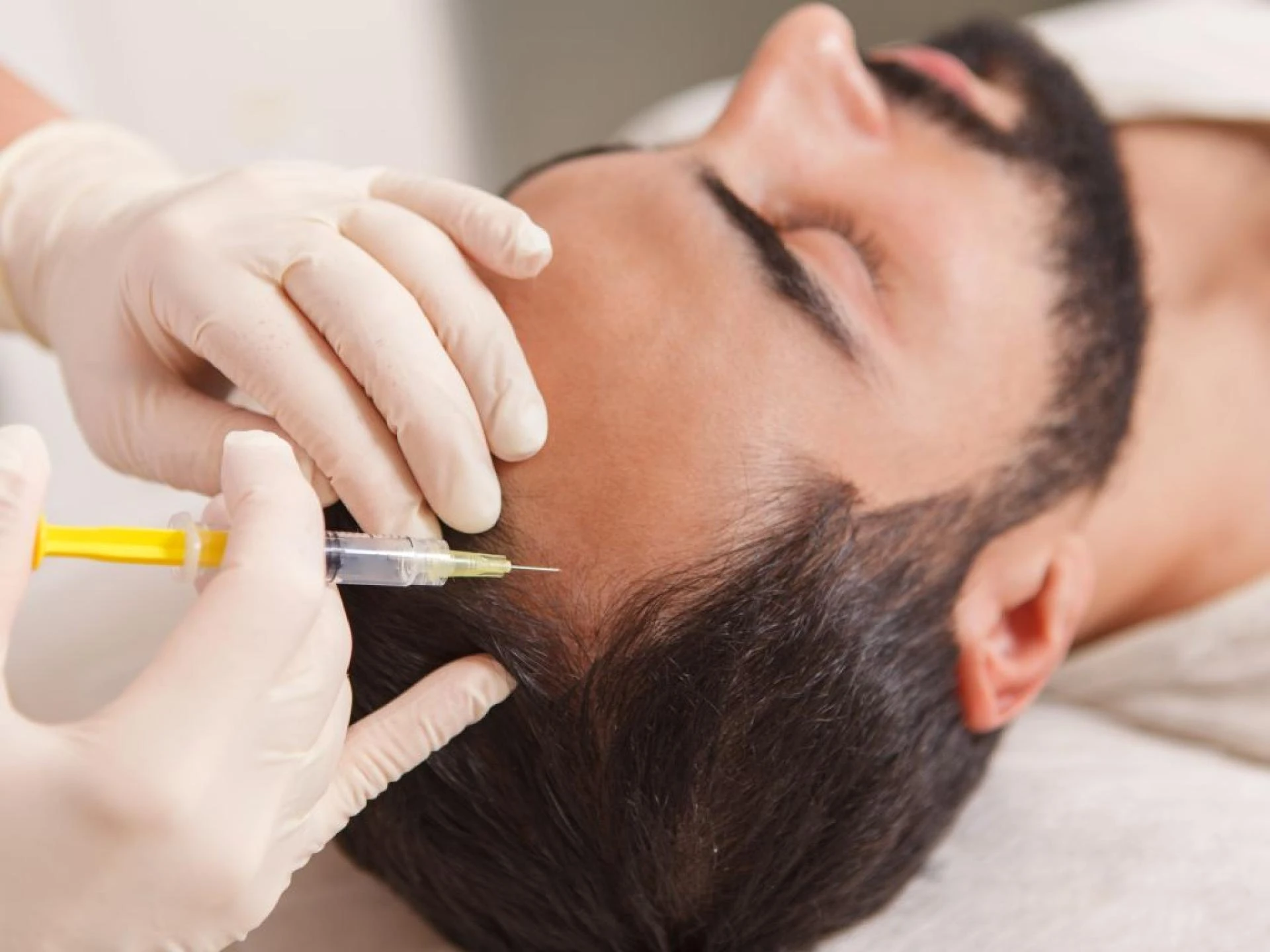Revive Your Hair Natural Discover the Magic of PRP Hair Treatment in India | QHT Hair Transplant
