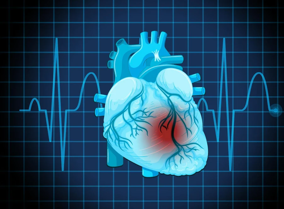 Is EECP Treatment Right for You? Symptoms & Consultation Tips