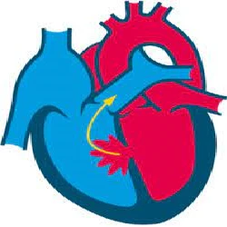 What are the Common Symptoms of Heart Problems in Kids?