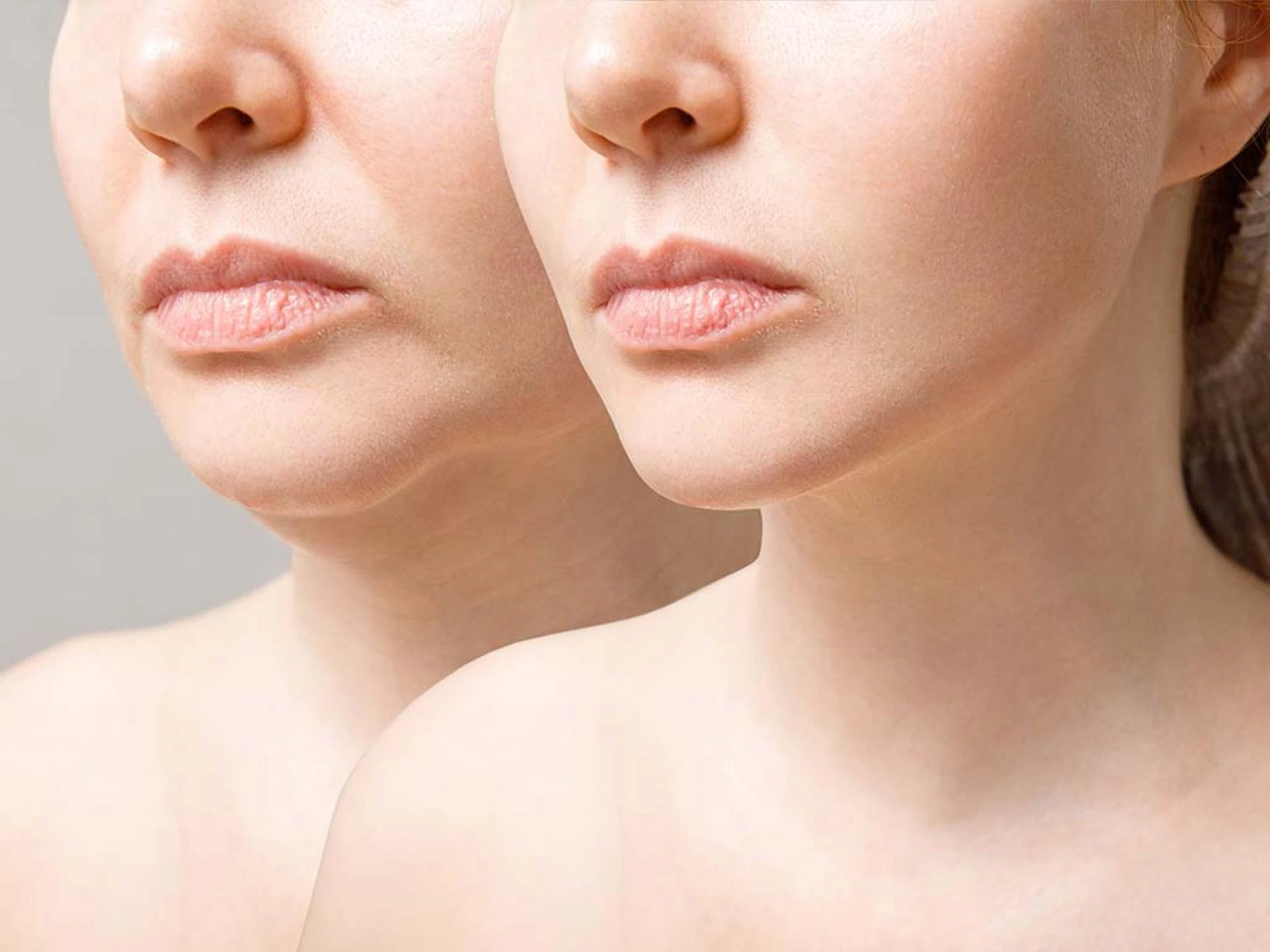 What Should You Know Before Getting a Facelift?