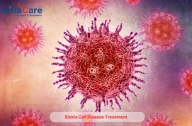 Benefits Of Bone Marrow Transplant For Sickle Cell Patients