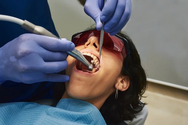 What to Expect During a Tooth Extraction A Guide for Patients in Baldwin ME