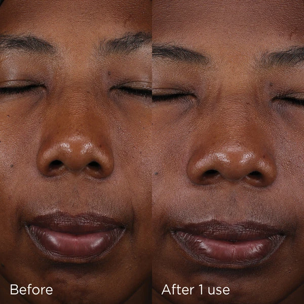 4 Skincare Trends to Look Forward to In 2025