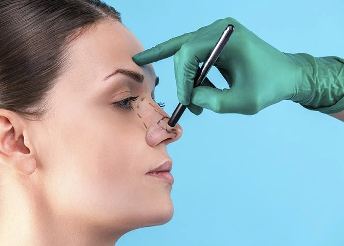 Take the First Step to Perfection – Book Rhinoplasty in Dubai