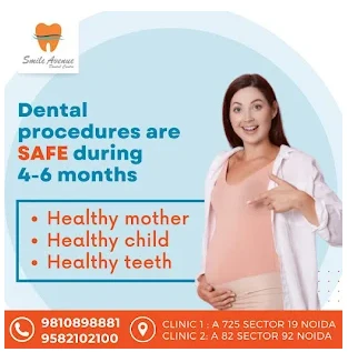 What can I do to keep my teeth white?