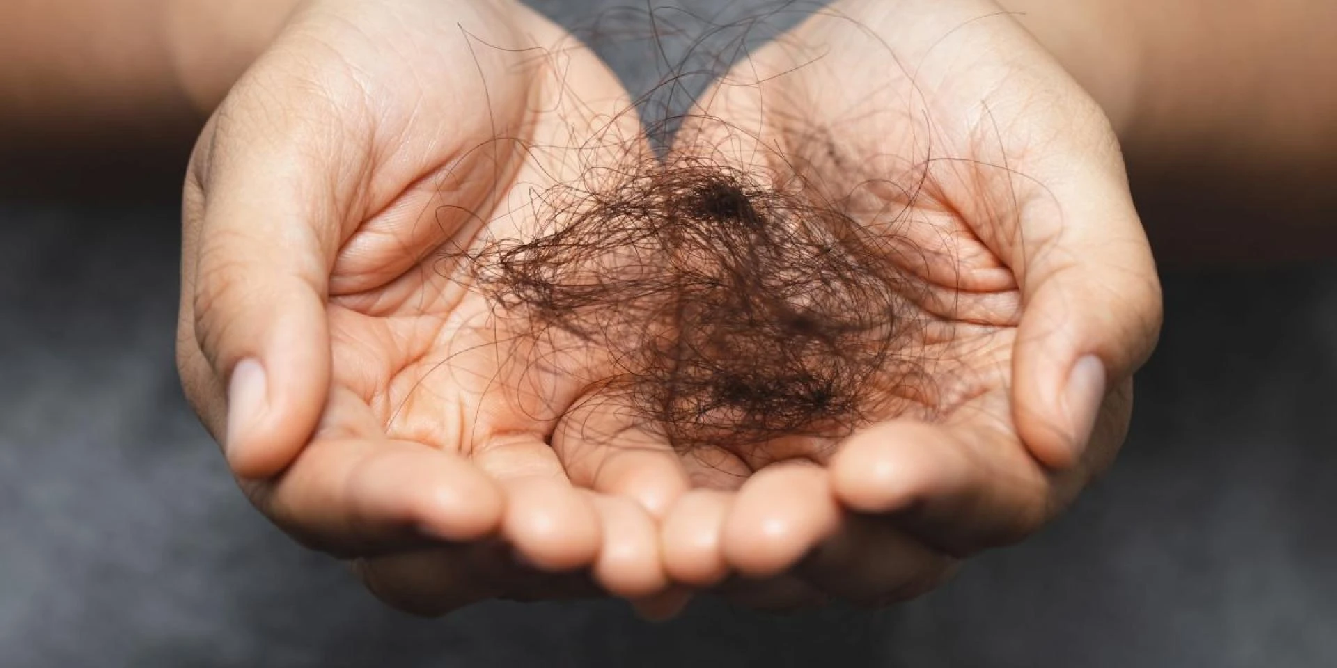 Homeopathic Treatments for Hair Fall: Natural Remedies for Healthy Hair