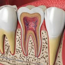 Expert Root Canal Treatment in Flower Mound, TX: Everything You Need to Know