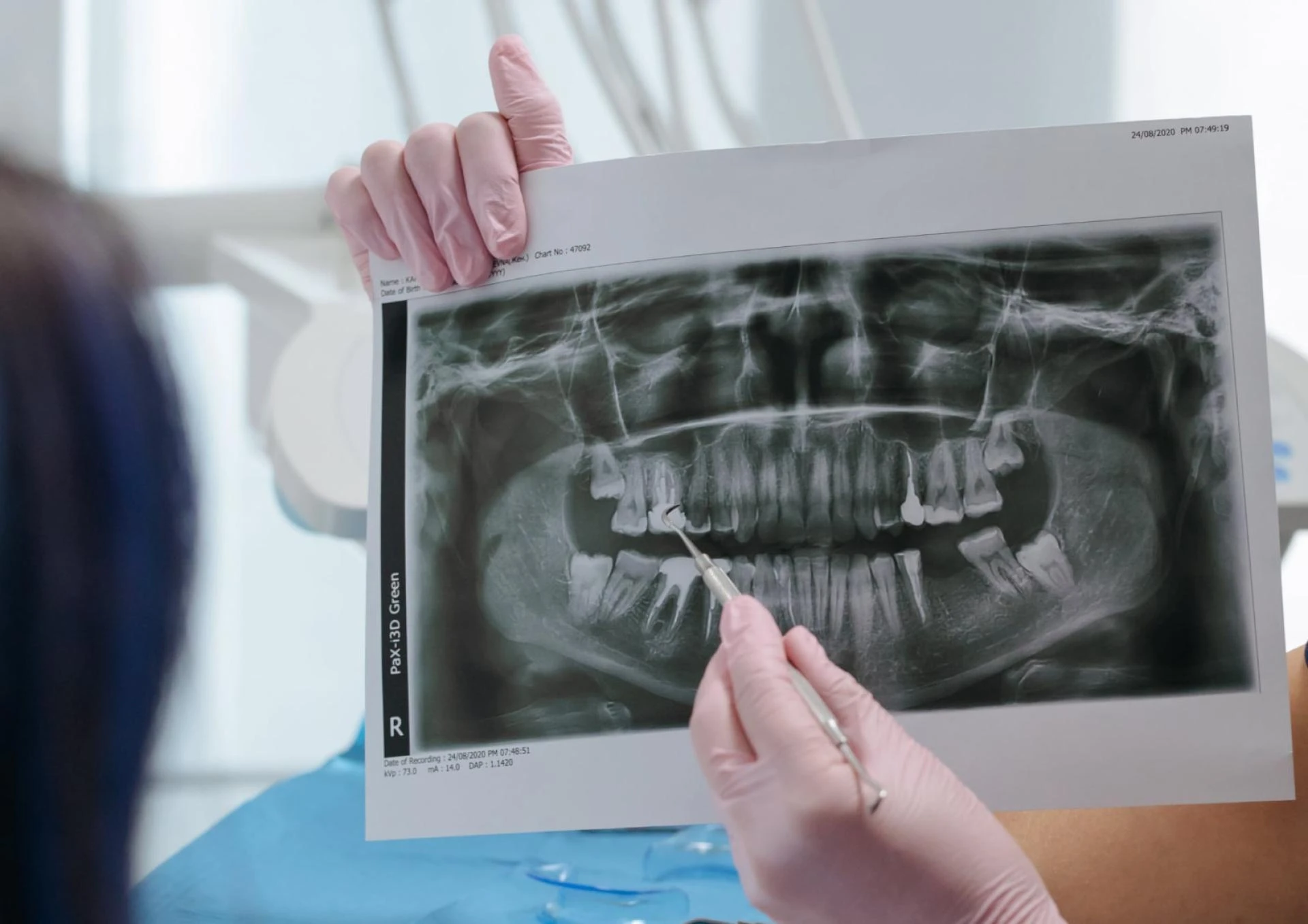 Exceptional General Dentistry in Harrison for a Healthy Smile