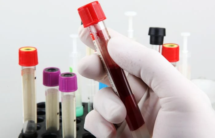 How to Choose the Best Pathology Lab in Pune for Accurate Test Results?
