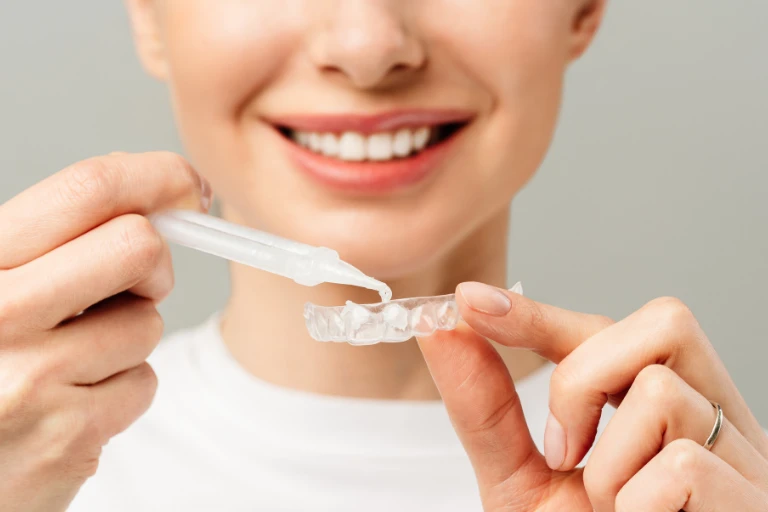 Brighten Your Smile with Professional Teeth Whitening in Sydney CBD