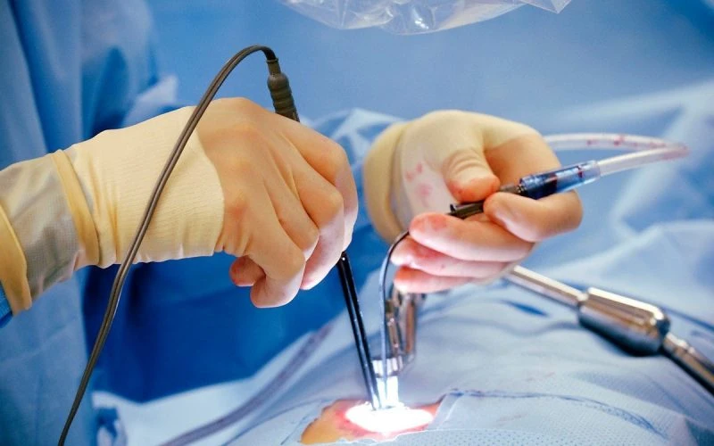 Best Non-Surgical Laser Treatment for Piles – Dr. Garje’s Piles Fistula Centre