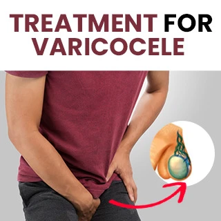 Best Varicocele Treatment: Natural & Non-Surgical Remedy