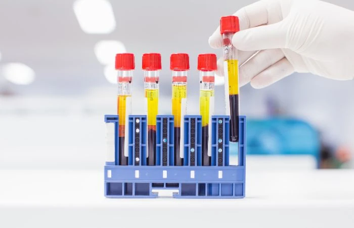 Food Allergy Testing: A Key to Managing Your Symptoms Effectively