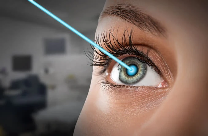How Long Do LASIK Results Last? Is It Permanent?