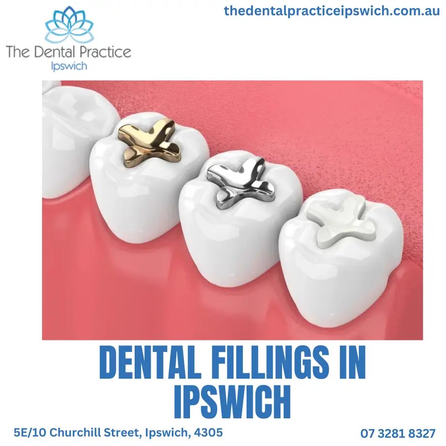 The Ultimate Guide to Dental Fillings in Ipswich: Everything You Need to Know