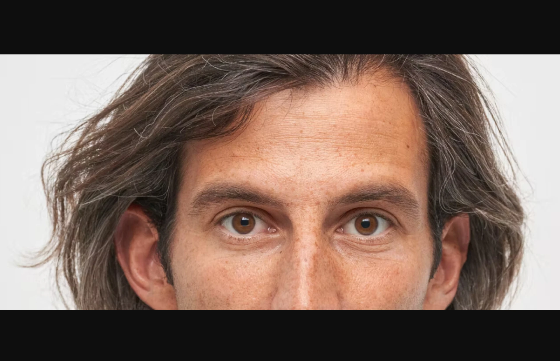 Cornea Damage Treatment Options: The Ultimate Guide to Restoring Your Vision