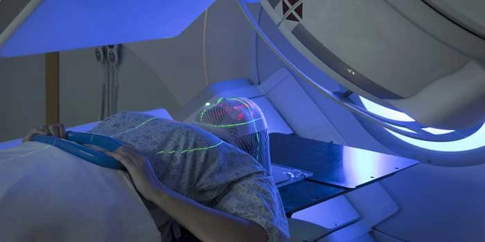 How Radiation Therapy Helps Treat Metastatic Cancer