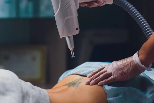 Laser Tattoo Removal in Glasgow: Safe and Effective Ways to Remove Tattoos