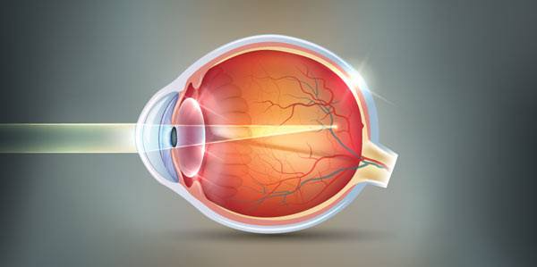 How to Find the Best Eye Clinic for Myopia Treatment in Hamilton?