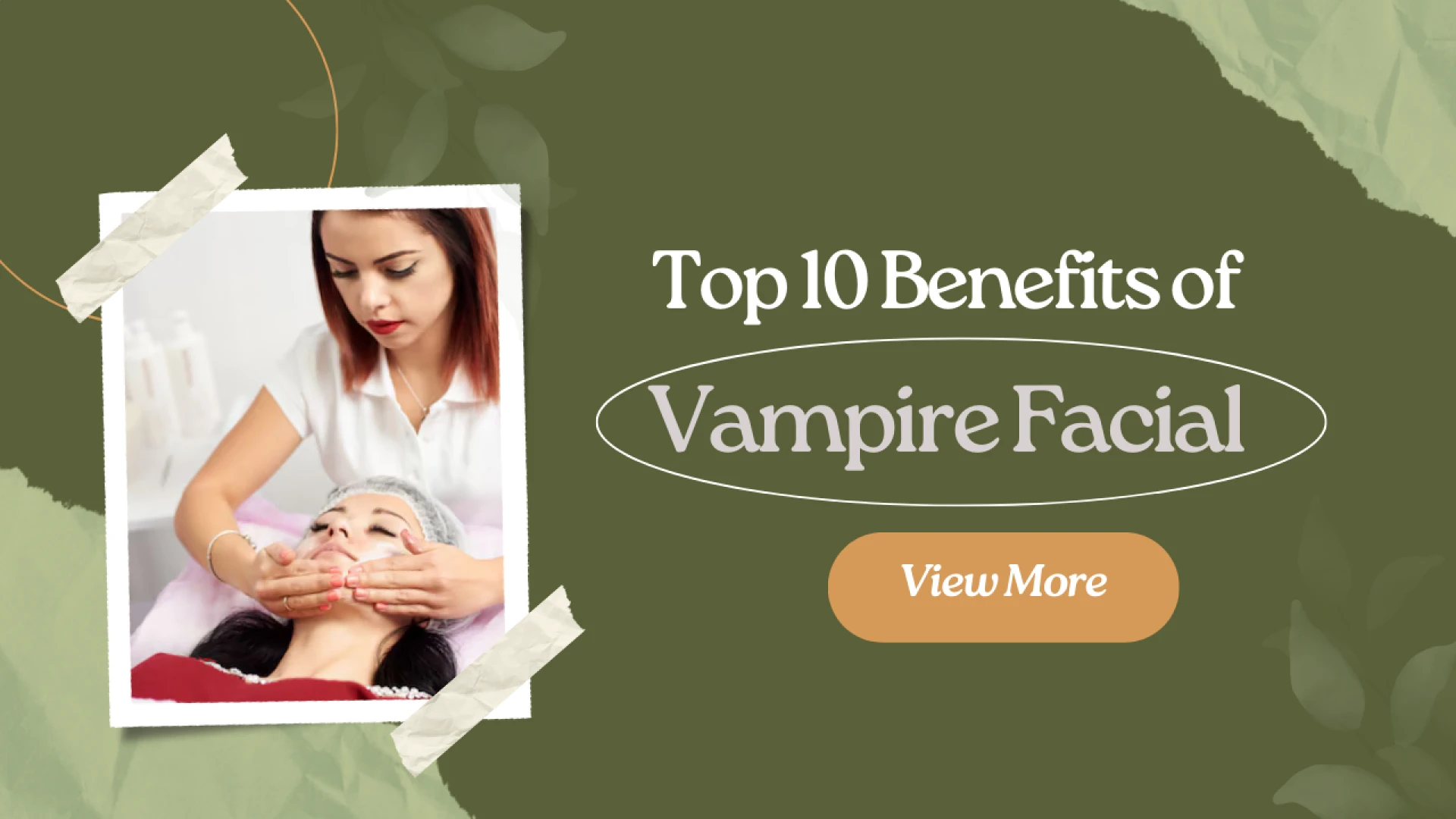 Vampire Facial