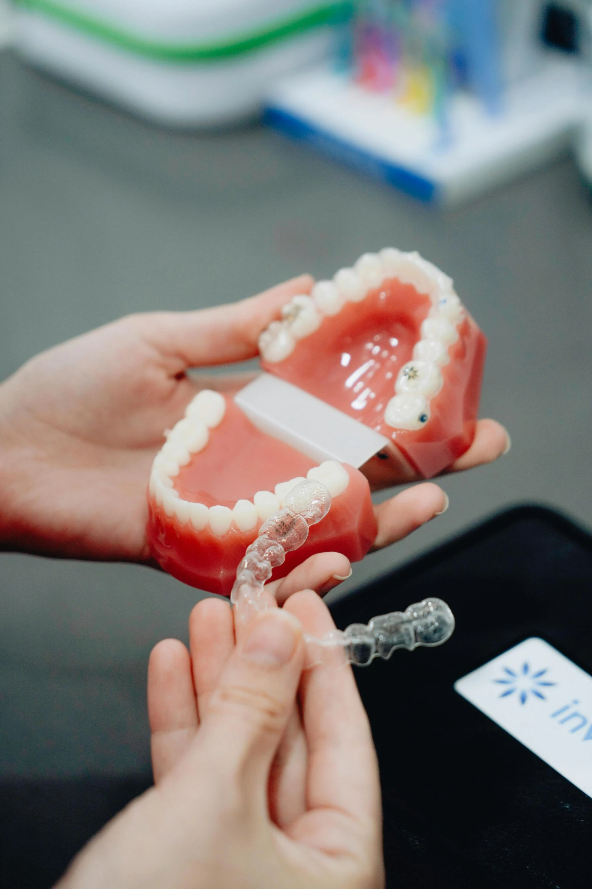 Top-Quality Dental Services at a Dental Practice and the Advantages of Invisalign