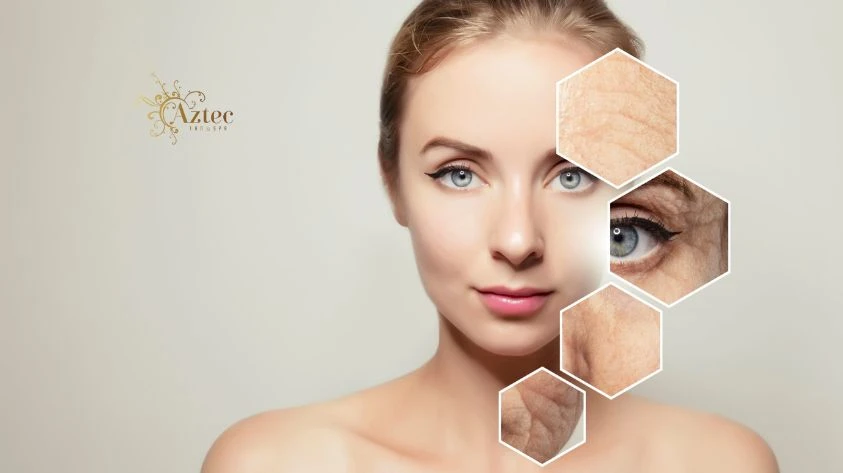 The Ultimate Guide to Face Lift Treatments in San Diego