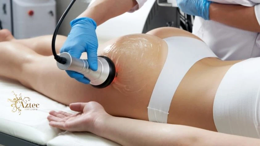The Ultimate Guide to Body Contouring and Skin Rejuvenation in San Diego