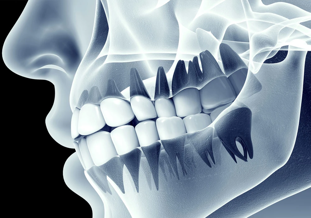 Dental X-Ray Centers in RR Nagar