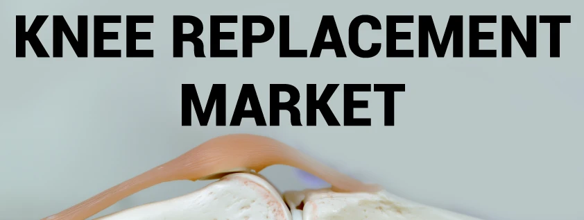 Knee Replacement Market, by Demand Analysis, Regions, Risk Analysis, Driving Forces and Application, Forecast to 2027.