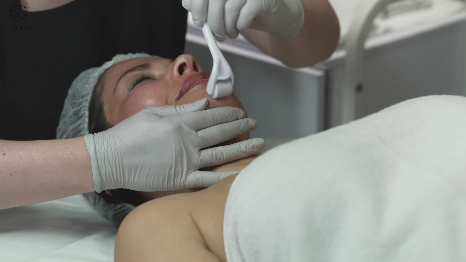SKIN NEEDLING AND HOW IT IMPROVES THE HEALTH OF THE SKIN