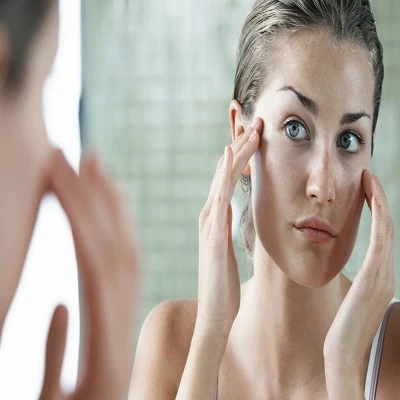 How can I prevent melasma from worsening?