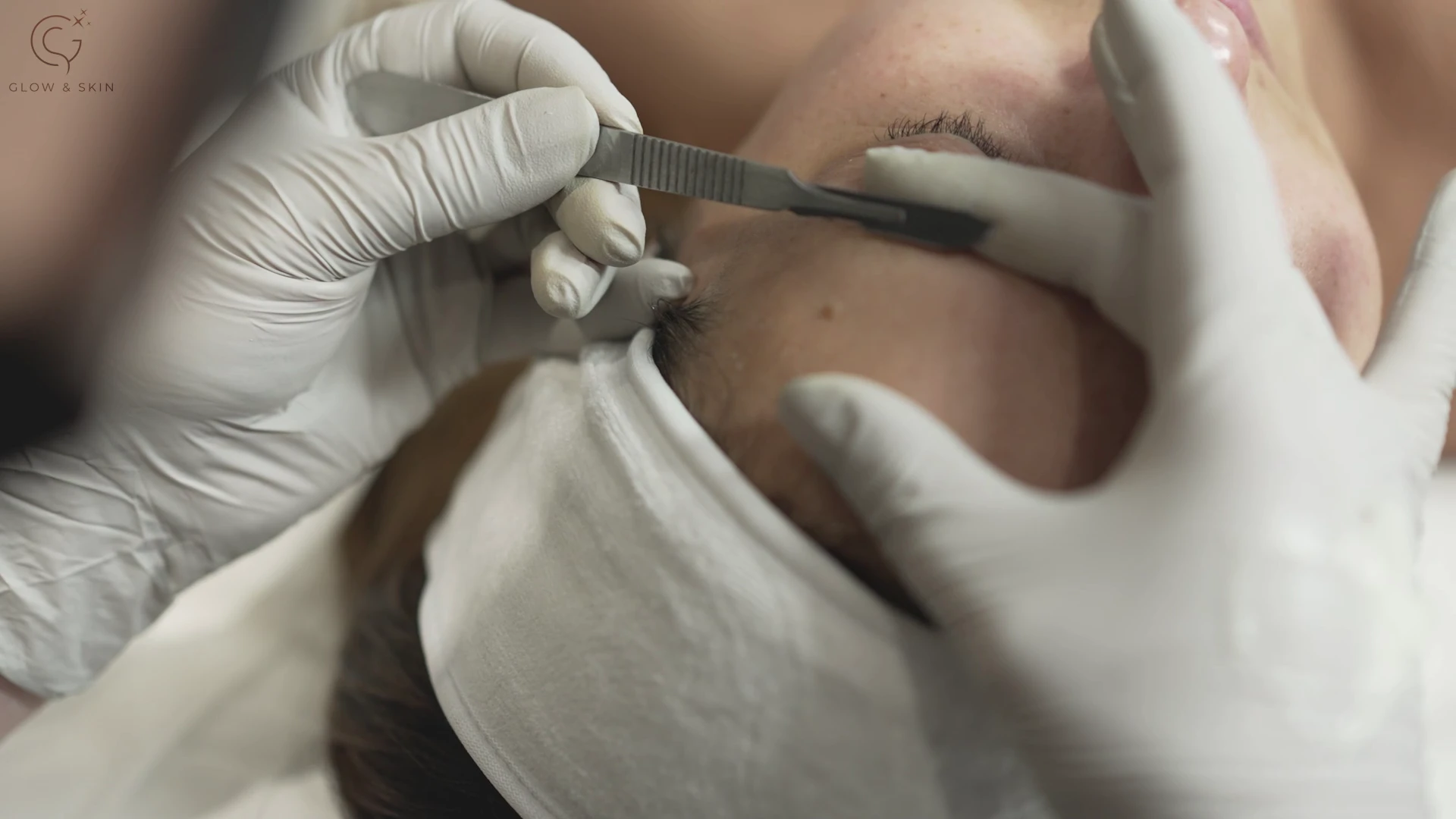 Dermaplaning and why it’s better with Glow & Skins Multipurpose balm?