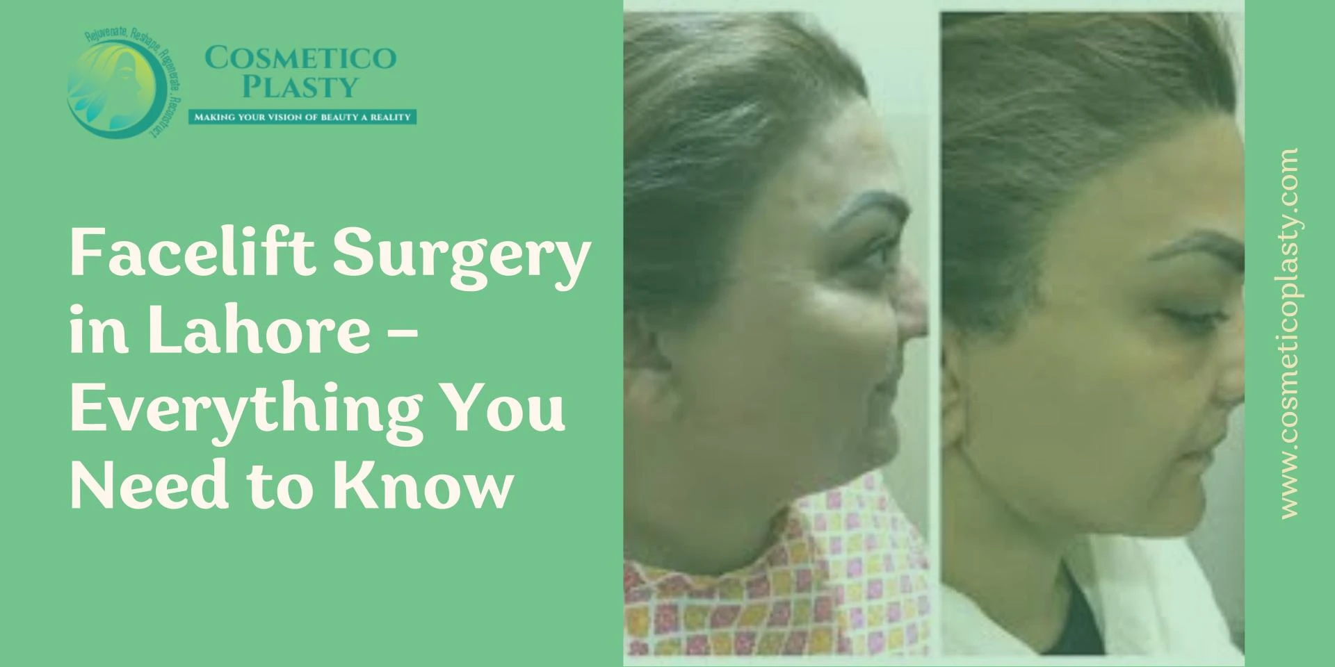 Facelift Surgery in Lahore – Everything You Need to Know