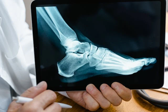 What is Ankle Surgery and Why This Needs to Be Done?