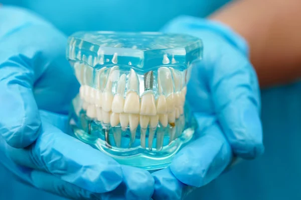 The Journey to Becoming an Implant Dentist the Importance of Specialized Training in Dentistry in Gulf Shores AL