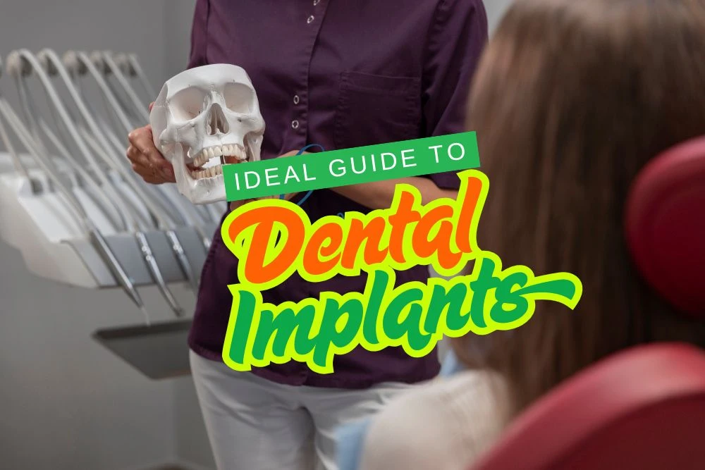 Ideal Guide to Dental Implants 2025