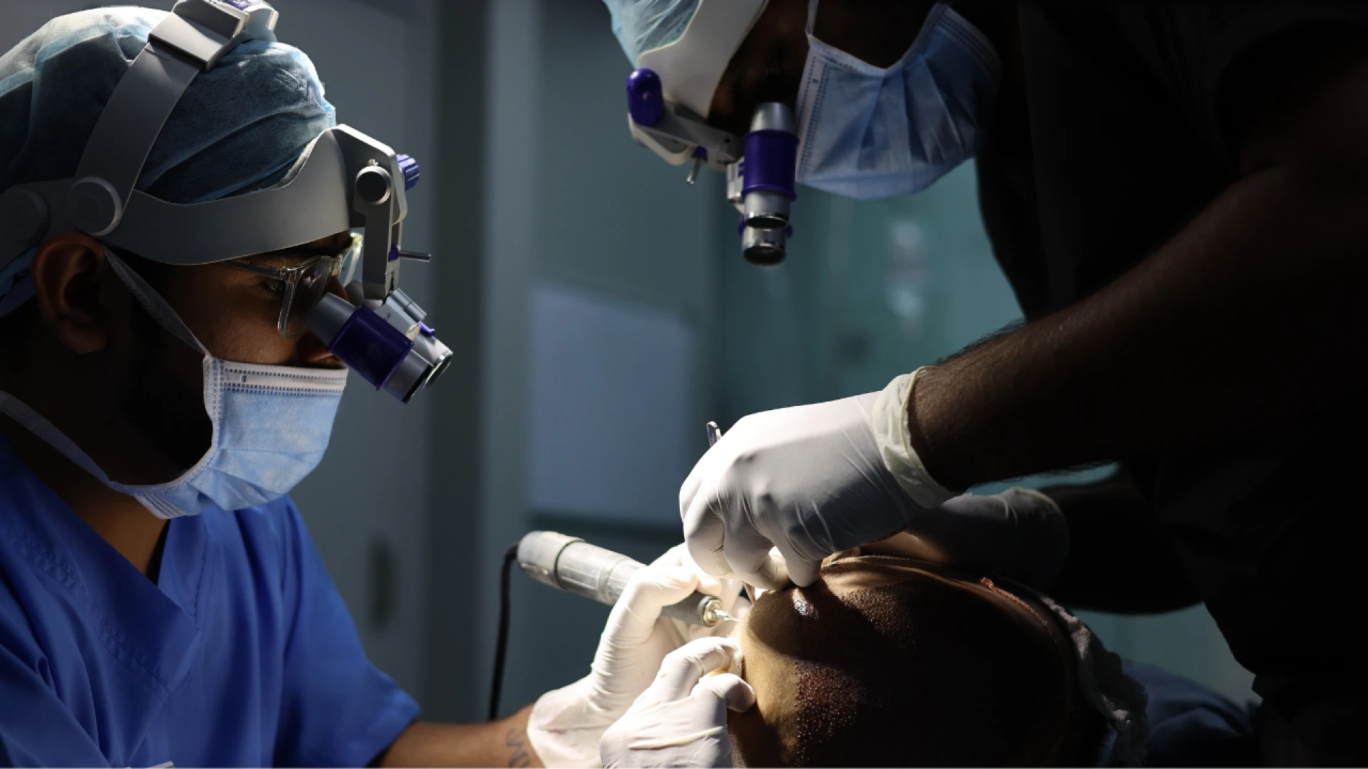 Hair Transplant in Delhi