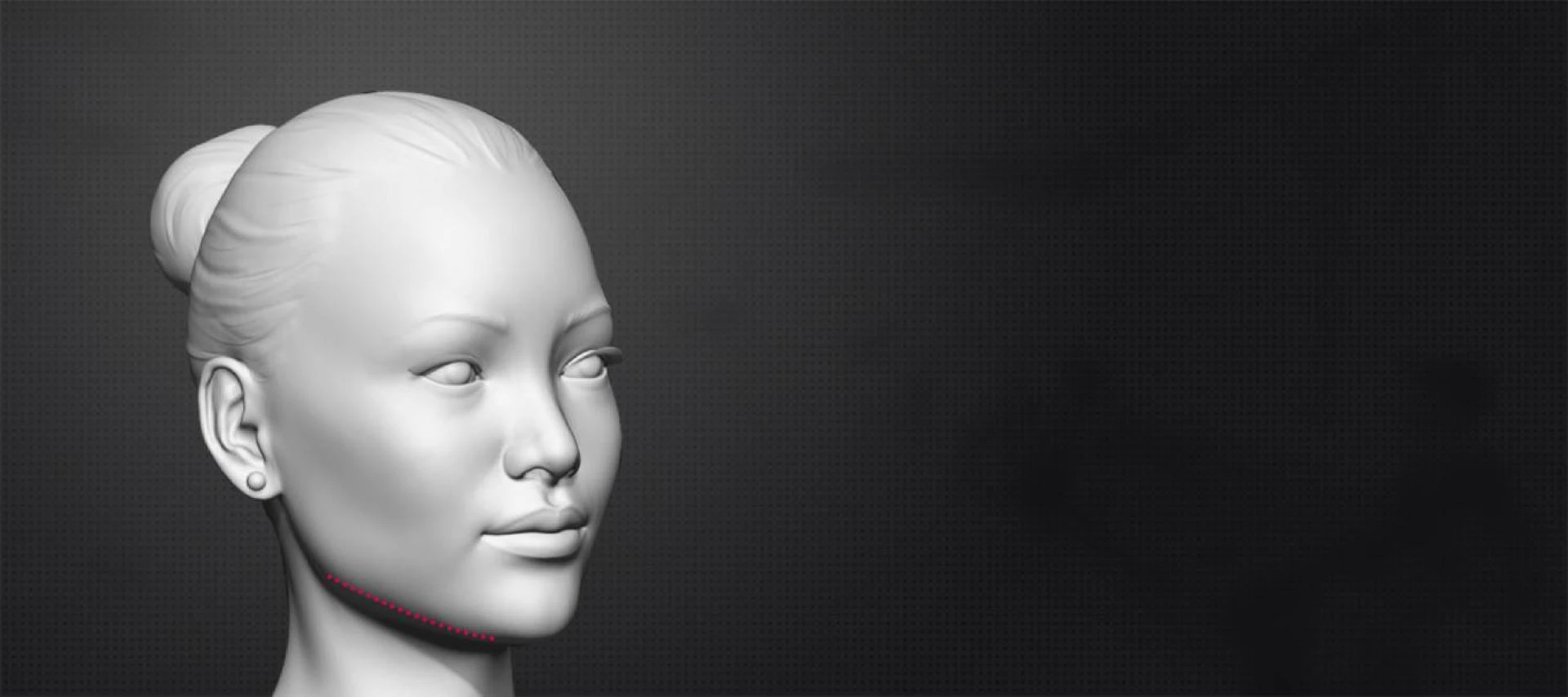 Facial Feminization Surgery: A Journey to Feminine Elegance