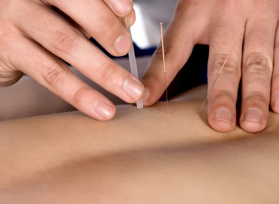 Find the Best Acupuncture Treatment Center in Chester