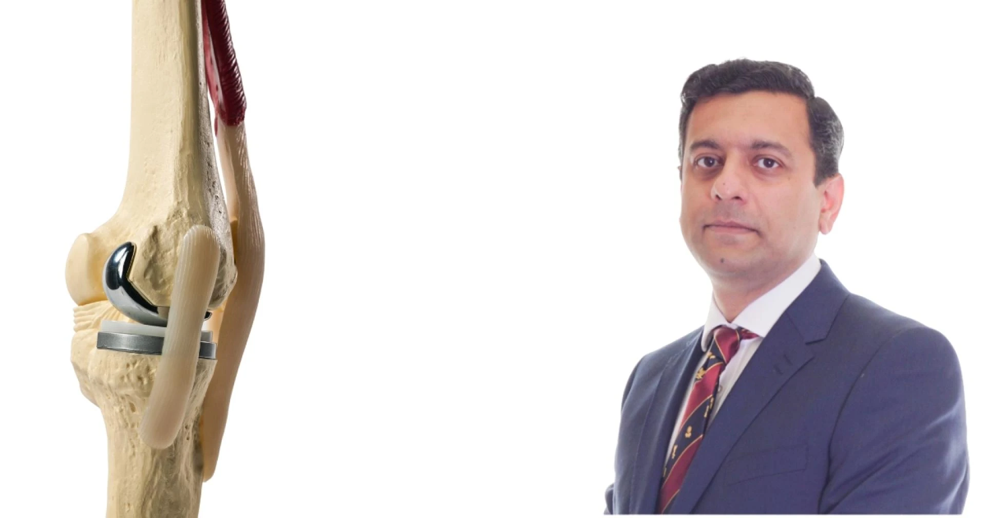 Top Knee Replacement Surgeon in Lahore | Trusted Orthopedic Specialist