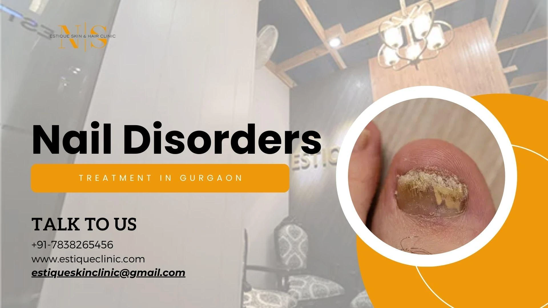 Can Nail Disorders be Treated?