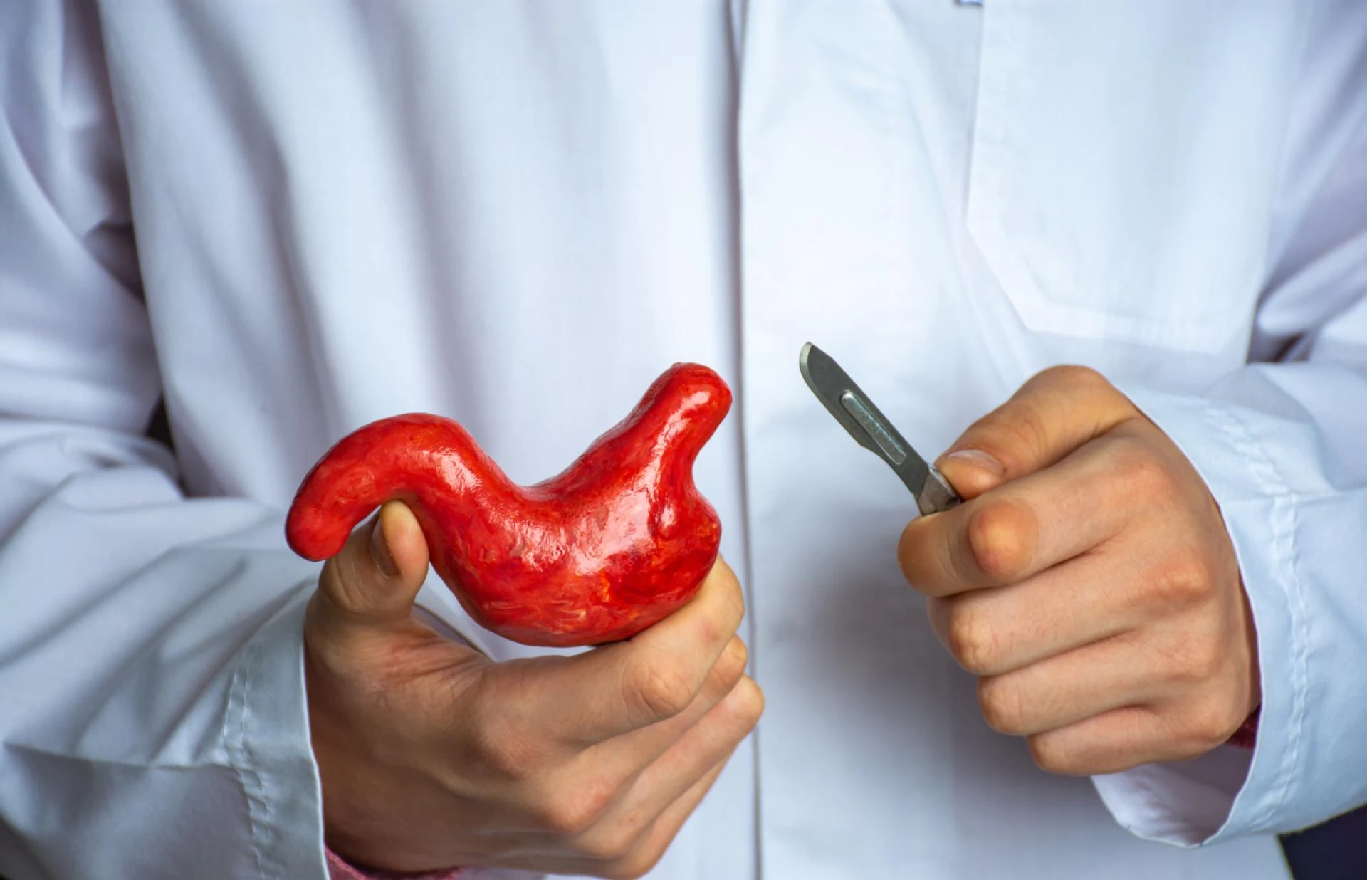 How Bariatric Surgery in Islamabad Affects Digestive Health