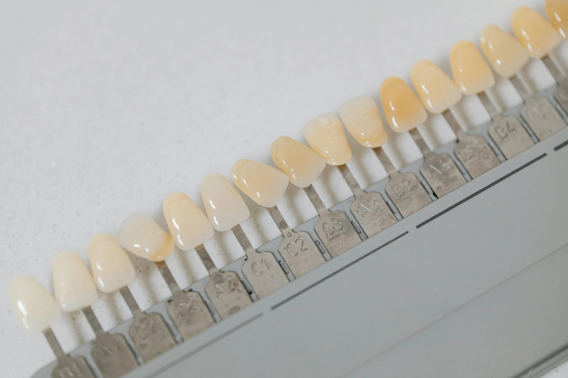 Everything You Need to Know About Dental Implants: Brands, Costs, and Long-Term Viability