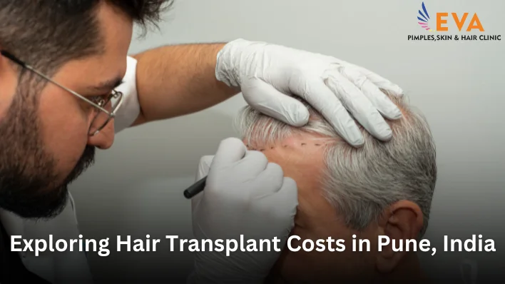 Understanding Hair Transplant and PRP Hair Treatment Costs in Pune