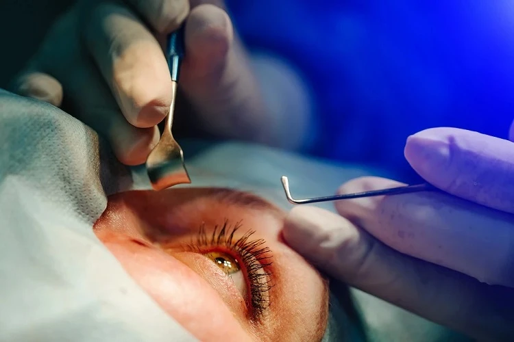An Eye Center near Hollywood Offers Advanced Treatment