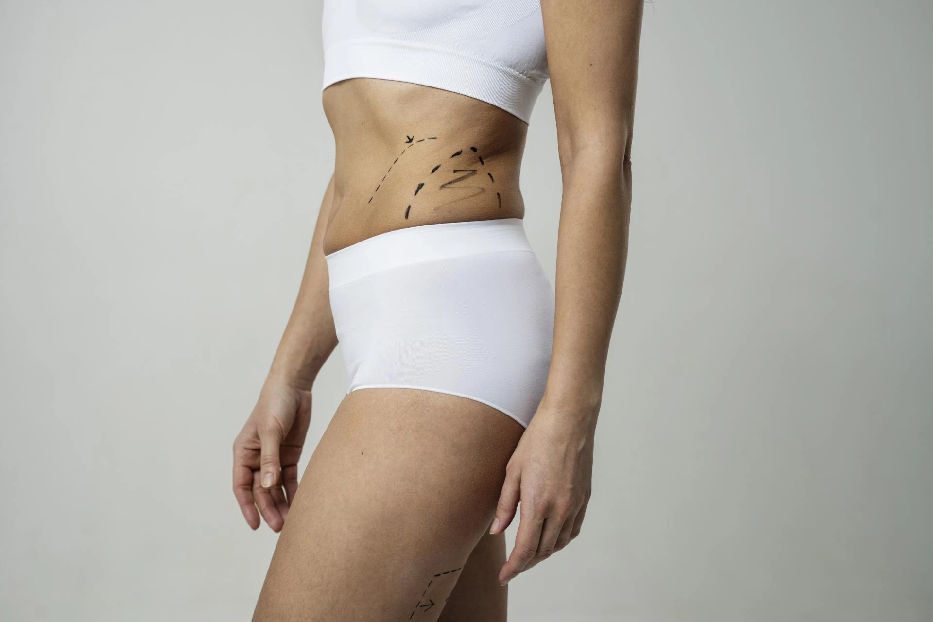 The Journey Continues Confidence Restored Through Liposuction in Dubai